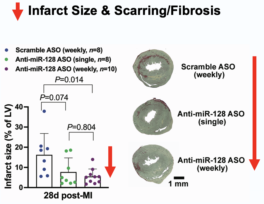 Infarct size and fibrosis